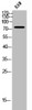 Western Blot analysis of RAW cells using GBP4 Polyclonal Antibody Western Blot analysis of RAW cells using GBP4 Polyclonal Antibody