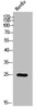 Western Blot analysis of HuvEc cells using Phospho-Casein Kinase IIβ (S209) Polyclonal Antibody