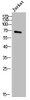 Western Blot analysis of Jurkat cells using DBH Polyclonal Antibody