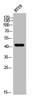 Western Blot analysis of HT-29 cells using EDG-3 Polyclonal Antibody Western Blot analysis of HT-29 cells using EDG-3 Polyclonal Antibody