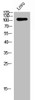 Western Blot analysis of LOVO cells using Glucosidase IIα Polyclonal Antibody