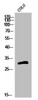 Western Blot analysis of COLO cells using Olfactory receptor 5H15 Polyclonal Antibody