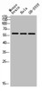 Western blot analysis of mouse-brain HELA SH-SY5Y lysis using Arylsulfatase E antibody.