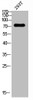 Western Blot analysis of 293T cells using Phospho-Tak1 (T187) Polyclonal Antibody