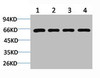 Western blot analysis of 1) Jurkat, 2) 293T, 3) C2C12, 4) Rat Kidney using Beclin-1 Polyclonal Antibody.