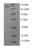 (Tris-Glycine gel) Discontinuous SDS-PAGE (reduced) with 5% enrichment gel and 15% separation gel.