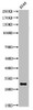 Western Blot analysis of A549 cells using Acetyl-ATF-5 (K29) Polyclonal Antibody