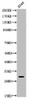 Western Blot analysis of A549 cells using Acetyl-ATF-5 (K29) Polyclonal Antibody