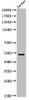 Western Blot analysis of Jurkat cells using Acetyl-p53 (K372) Polyclonal Antibody