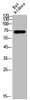 Western Blot analysis of rat kidney cells using Acetyl-HSP70 (K246) Polyclonal Antibody