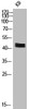 Western Blot analysis of KB cells using Phospho-ERK 1/2 (T202) Polyclonal Antibody