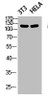 Western blot analysis of 3T3 HELA lysis using Phospho-FAK (Y861) antibody.