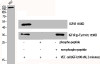 Western Blot analysis of VEC cells using Phospho-IGF-IR (Y1161) Polyclonal Antibody