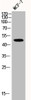 Western Blot analysis of MCF-7 cells using Phospho-JNK1/2/3 (T183) Polyclonal Antibody
