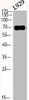 Western Blot analysis of L929 cells using Phospho-p70 S6 kinase α (T229) Polyclonal Antibody