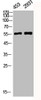 Western Blot analysis of 453 293T cells using Phospho-CaMKIIα/β/δ (T305) Polyclonal Antibody