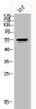 Western Blot analysis of 3T3 cells using Phospho-HDAC2 (S394) Polyclonal Antibody