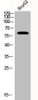 Western Blot analysis of HEPG2 cells using Phospho-Akt (T308) Polyclonal Antibody