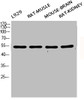 Western Blot analysis of L929 RAT-MUSCLE MOUSE-BRAIN RAT-KIDNEY cells using Phospho-Smad3 (S425) Polyclonal Antibody