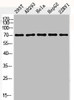 Western Blot analysis of 293T AD293 HELA HepG2 22RV1 cells using Phospho-c-Fos (S362) Polyclonal Antibody