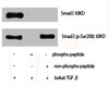 Western Blot analysis of Jurkat cells using Phospho-Smad3 (S208) Polyclonal Antibody