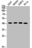 Western Blot analysis of 293T AD293 22RV1 HELA cells using Phospho-c-Myc (S62) Polyclonal Antibody