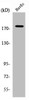 Western Blot analysis of HuvEc cells using ABCA8 Polyclonal Antibody