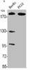 Western Blot analysis of HuvEc PC12 cells using ABCA8 Polyclonal Antibody