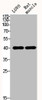 Western Blot analysis of LOVO mouse-muscle cells using Actin α1 Polyclonal Antibody