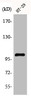 Western Blot analysis of HT29 cells using Actinin-α3 Polyclonal Antibody