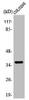 Western Blot analysis of COLO205 cells using Apaf-1-ALT Polyclonal Antibody