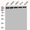 Western Blot analysis of 293T AD293 22RV1 HELA HepG2 cells using BAF170 Polyclonal Antibody