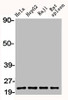 Western Blot analysis of HELA HepG2 RAJI RAT-SPLEEN cells using Bax Polyclonal Antibody