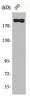 Western Blot analysis of 293 cells using BRCA1 Polyclonal Antibody