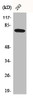 Western Blot analysis of 293 cells using Btk Polyclonal Antibody