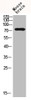 Western Blot analysis of mouse-brain cells using Btk Polyclonal Antibody