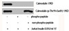 Western Blot analysis of Jukat+Insulin cells using Calmodulin Polyclonal Antibody