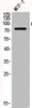 Western Blot analysis of MCF7 cells using Catenin-β Polyclonal Antibody