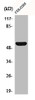 Western Blot analysis of COLO205 cells using CD4 Polyclonal Antibody