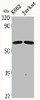 Western Blot analysis of K562 Jurkat cells using CDYL2 Polyclonal Antibody