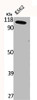 Western Blot analysis of K562 cells using CLC-6 Polyclonal Antibody