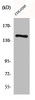 Western Blot analysis of COLO205 cells using COL2A1 Polyclonal Antibody