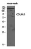 Western Blot analysis of rat-musle cells using COL4A1 Polyclonal Antibody