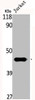 Western Blot analysis of Jurkat cells using Creatine Kinase M Polyclonal Antibody