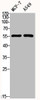 Western Blot analysis of MCF7 A549 cells using Cytokeratin 8 Polyclonal Antibody