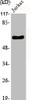 Western Blot analysis of Jurkat cells using EAAT3 Polyclonal Antibody