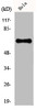 Western Blot analysis of COLO205 cells using GRK 5 Polyclonal Antibody