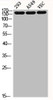 Western Blot analysis of 293 A549 VEC cells using Histone deacetylase 6 Polyclonal Antibody Western Blot analysis of 293 A549 VEC cells using Histone deacetylase 6 Polyclonal Antibody