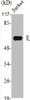 Western Blot analysis of Jurkat cells using IL-20Rα Polyclonal Antibody