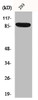 Western Blot analysis of 293 cells using IL-4Rα Polyclonal Antibody